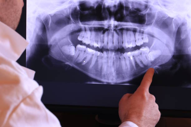 Best Walk-In Emergency Dentist in Lake In The Hls, IL