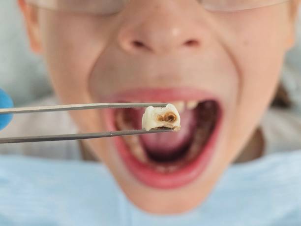 Best Same-Day Emergency Dentist in Lake In The Hls, IL
